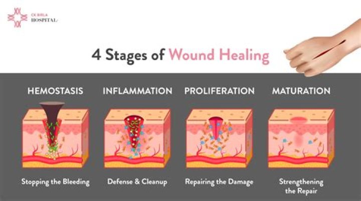 How do I heal a specific limb?