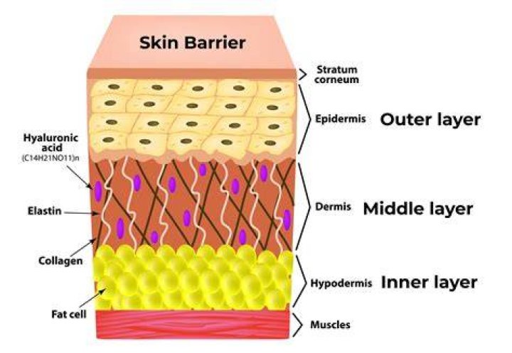 My skin isn't loading [closed]