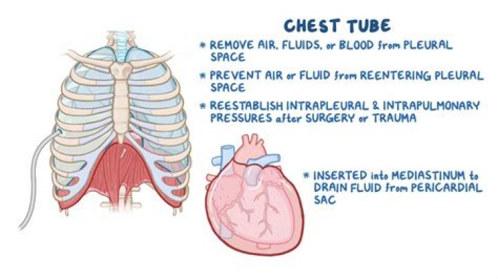 the chest can be seen at the right