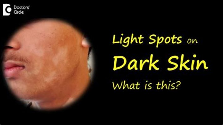 What are glowing spots with the Mask of Truth?