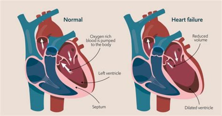 What heart pieces are unavoidable?